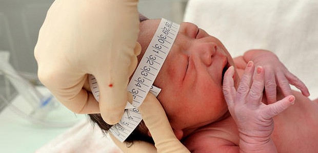 Enfermeira mede a cabeça de criança recém-nascida para verificar sinais de microcefalia (Foto: Reprodução/YouTube)
