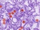 Gravidez prolonga ação de vírus da zika, diz estudo com primatas
