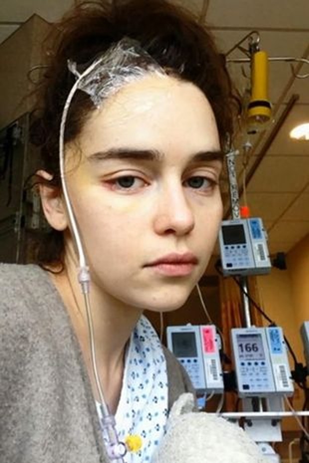 Emilia Clarke chegou a postar foto nas redes sociais para falar do aneurisma na época (Foto: Reprodução )