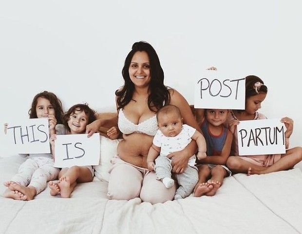 Mãe publica foto da barriga no pós-parto e promove reflexão