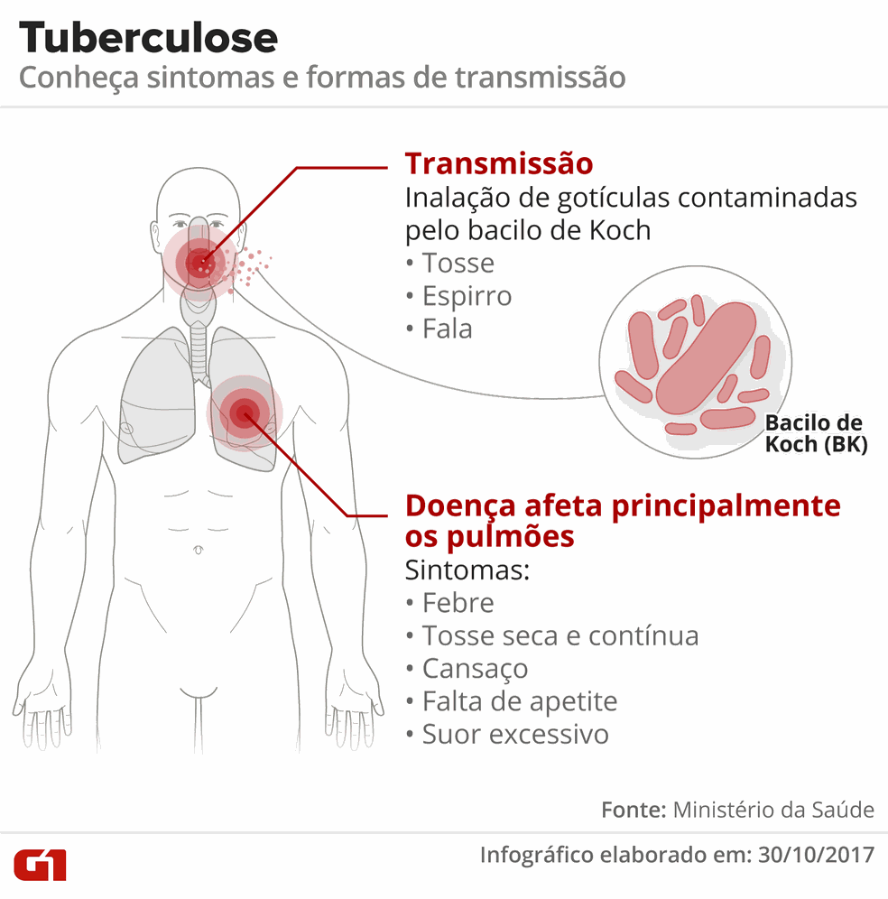 Tuberculose: sintomas e formas de transmissão (Foto: Arte G1)