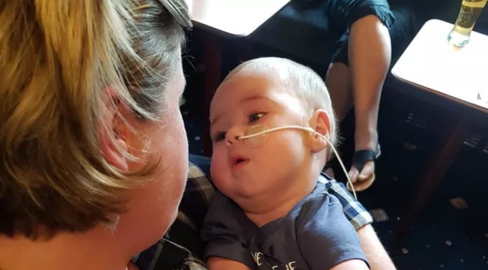 EUA: bebê brasileira com síndrome rara consegue transplante