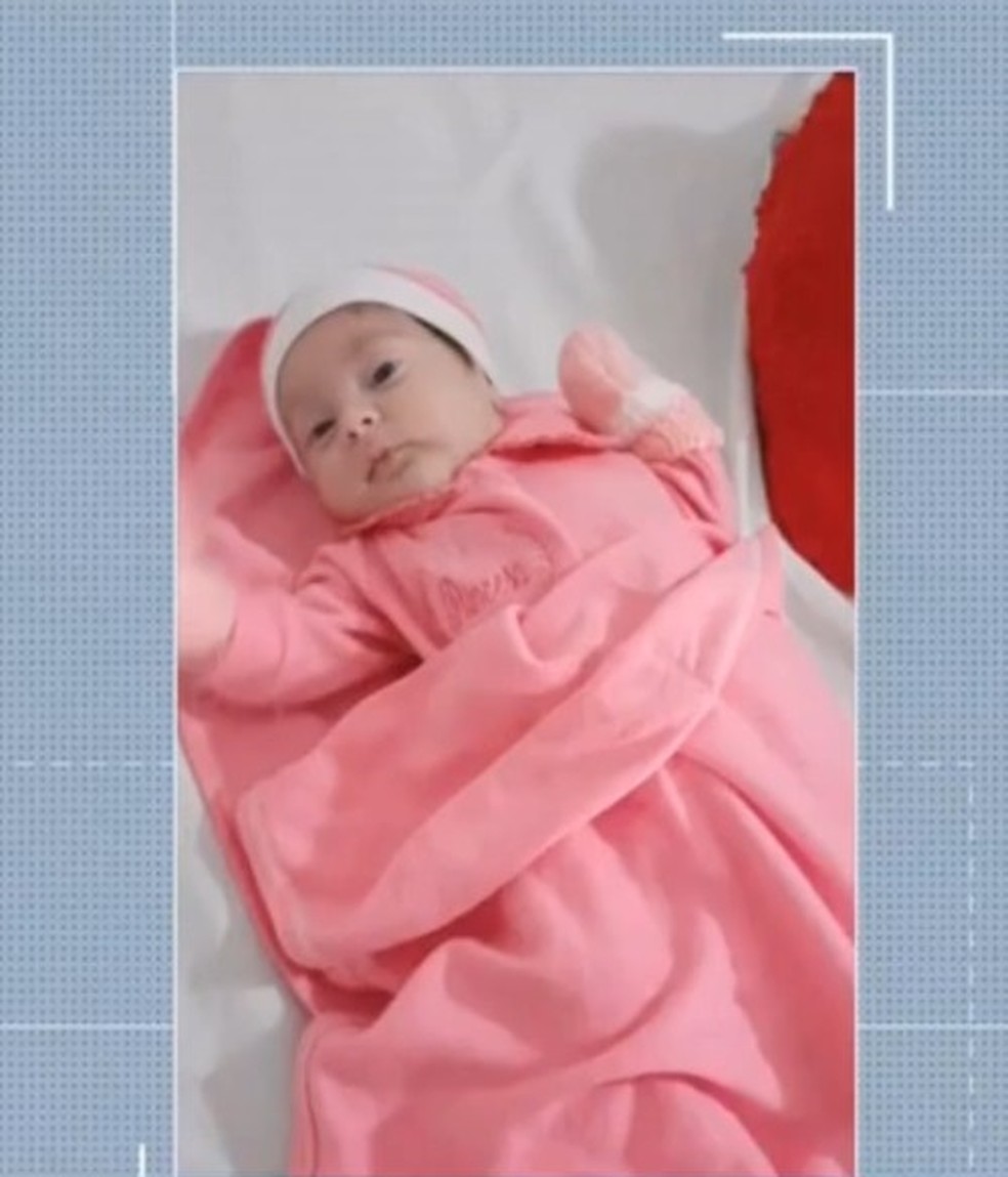 Bebê que teve couro cabeludo arrancado durante parto recebe alta depois de 43 dias internada