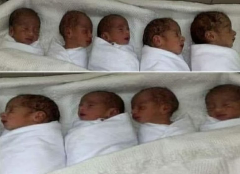 Bebês nasceram prematuros (Foto: Reprodução/Daily Mail)