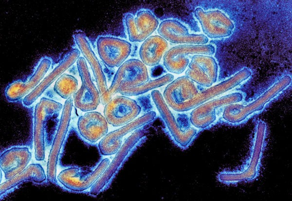 Partículas coloridas do vírus Marburg vistas com um microscópio eletrônico de transmissão (Foto: Tom Geisbert/Flickr/Creative Commons )