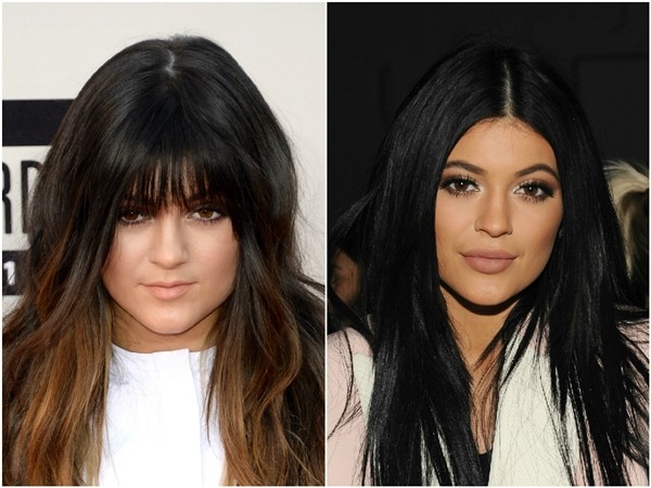 Kylie Jenner em 2013 e 2015 (Foto: Getty Images)