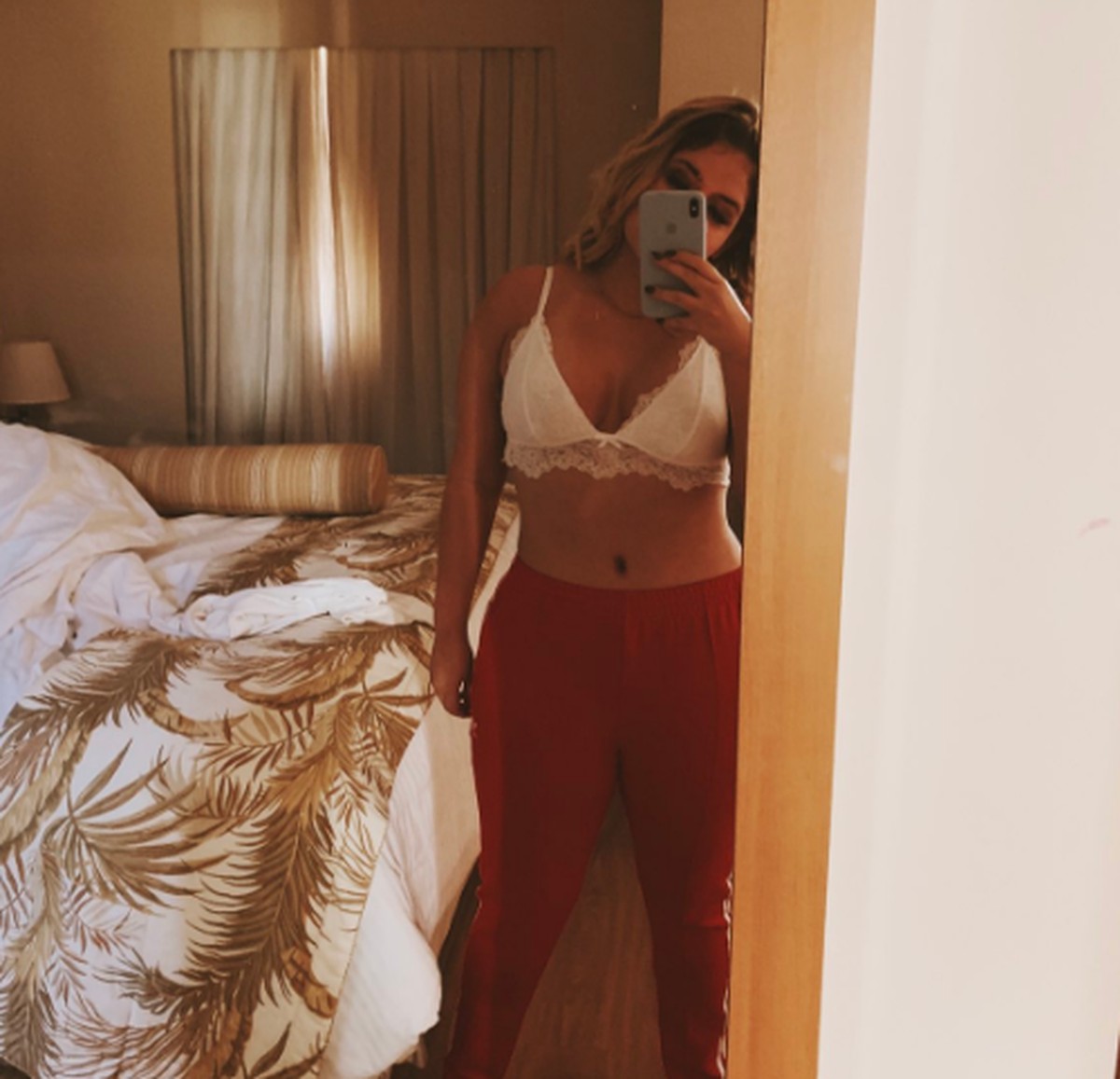 Get Cicatriz Abdominoplastia Antes E Depois PNG