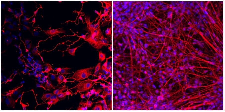 Reprogramação celular identifica causas de deficiência intelectual grave.Na imagem da esquerda é possível observar neurônios derivados de células de um paciente com deficiência intelectual. À direita, neurônios derivados de células de um parente não afetado. (Foto: Thalita Figueiredo/CEGH-CEL)