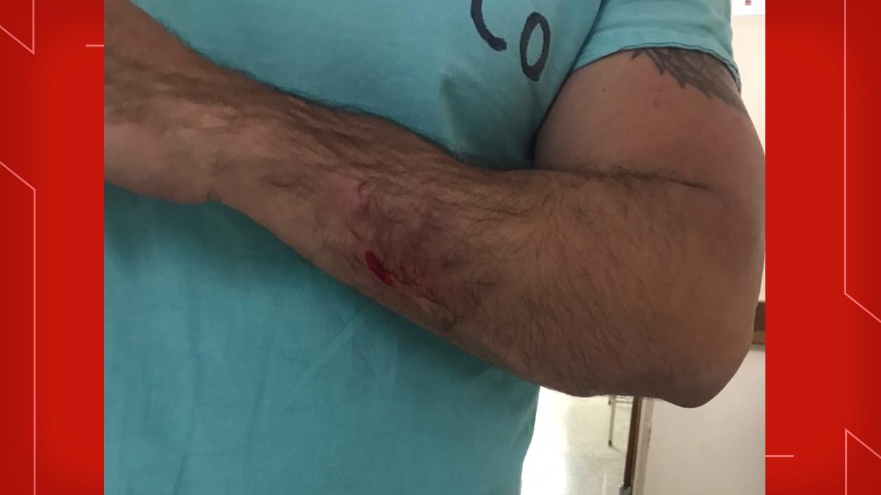Técnico de enfermagem é agredido a socos por acompanhante de paciente em hospital do DF