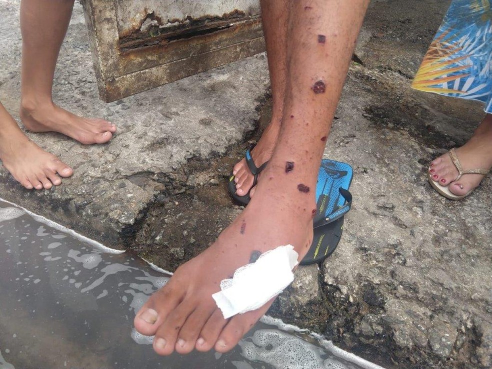 Morador da região de Osasco onde PM reprimiu protesto mostra perna ferida, atingida por fragmentos de artefatos disparados por policiais, segundo a Rede — Foto: Reprodução/Redes Sociais