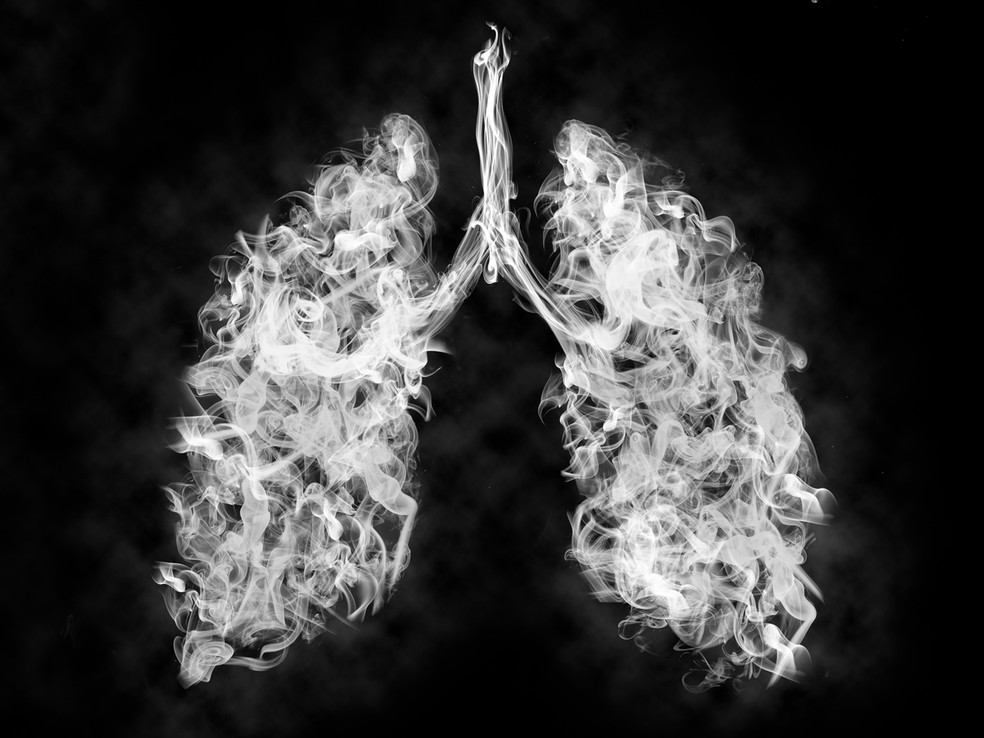 A fumaça aquecida do cigarro eletrônico contém partículas ultrafinas de substâncias que conseguem ultrapassar a barreira alveolar dos pulmões — Foto: Istock Getty Images