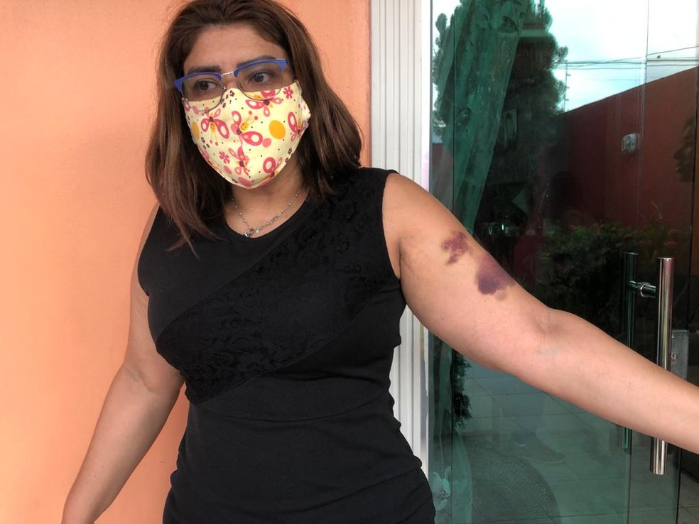 Universitária é agredida por grupo de vizinhos em Manaus após ouvir comentários racistas. — Foto: Rebeca Beatriz/G1 AM