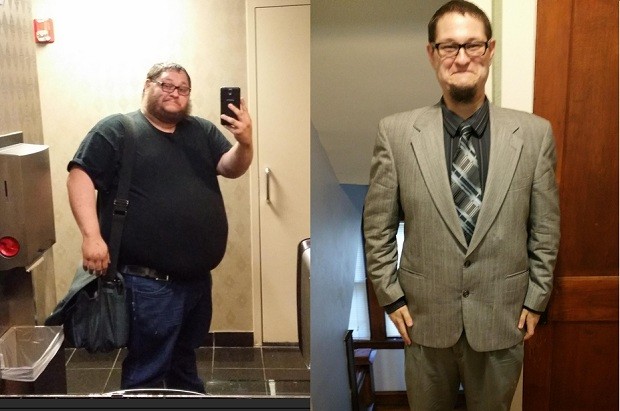 Eric Ziegler, antes e depois (Foto: Reprodução/ Imgur)