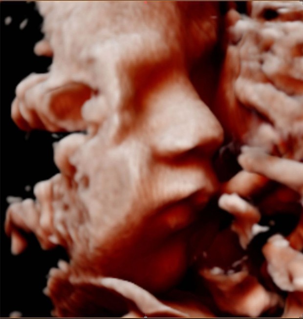 Gabi Brandt mostra rostinho de Henri em ultrassom (Foto: Reprodução / Instagram)