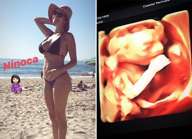 Bianca Muller anuncia gravidez (Foto: Reprodução / Instagram)