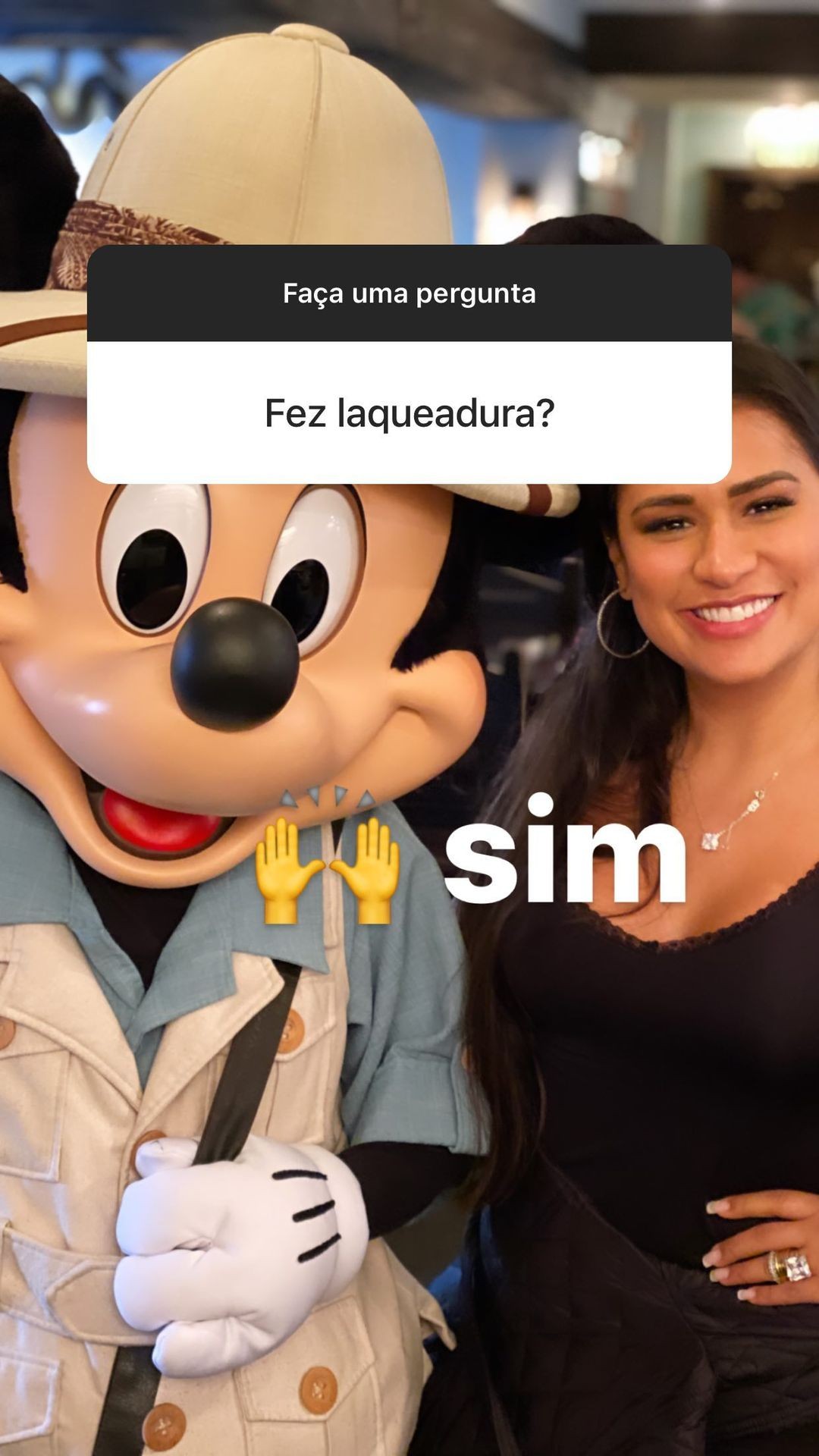 Simone revela que fez laqueadura após o parto de Zaya