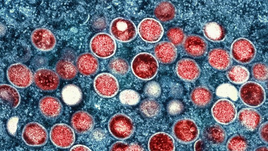 Ministério da Saúde confirma sexto caso de varíola dos macacos no Brasil