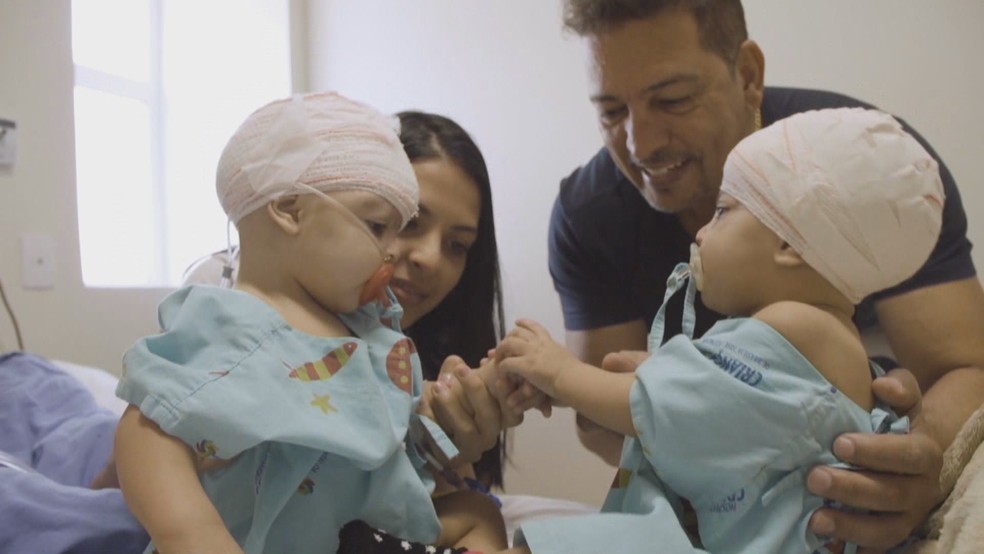 Gêmeas Lis e Mel se reencontram pela primeira vez depois de cirurgia inédita em Brasília  — Foto: TV Globo/Reprodução 