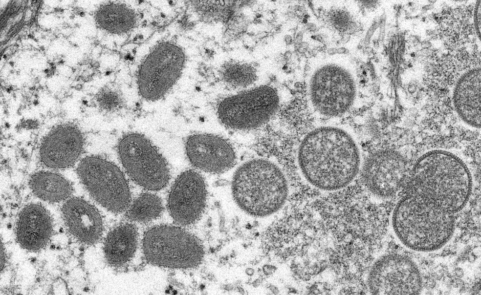 Vírus da 'varíola dos macacos' — Foto: Centro de Controle de Doenças/Divulgação