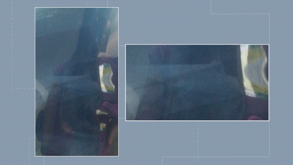 Exame de imagem mostra faca no torax de homem que aguarda cirurgia no Hospital Regional de Taguatinga (HRT) — Foto: Arquivo pessoal 