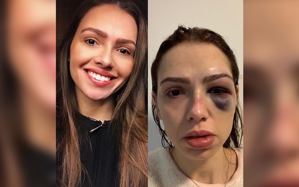 Tatiany Arci registrou boletim de ocorrência após agressões em casa noturna Villa Country — Foto: Arquivo Pessoal
