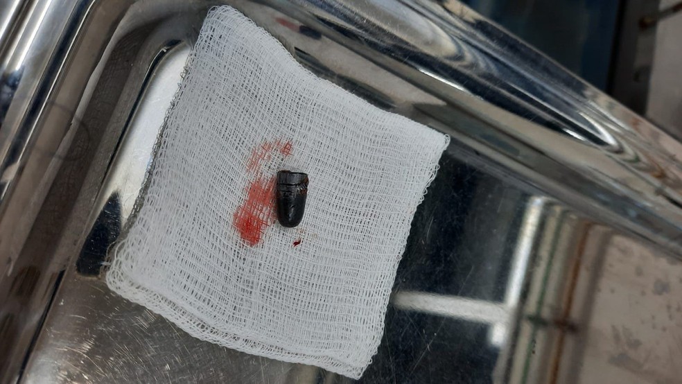Homem foi atingido por bala perdida em Coari, no interior do Amazonas. — Foto: Arquipo Góes/Rede Amazônica