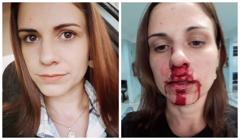 Jackeline postou foto do rosto ensanguentado após ser agredida — Foto: Arquivo pessoal