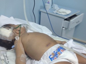 Bebê está internado há mais de um mês aguardando cirurgia em Palmas (Foto: Ludmylla Abreu/TV Anhanguera TO)