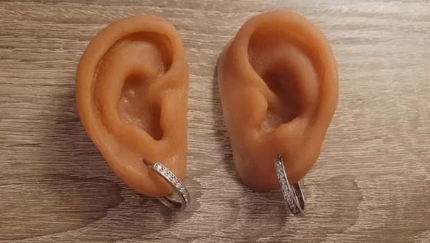 As orelhas foram fixadas na cabeça de Janet por meio de ímãs que se prendem a implantes em seu crânio (Foto: BBC)