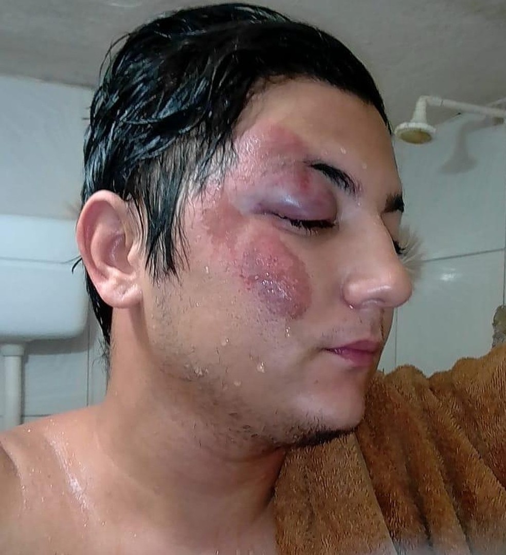 Vítima de homofobia é espancado por 4 homens em lanchonete no Ceará — Foto: Arquivo pessoal