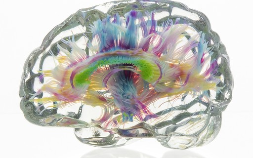 Com Voxels As Impressoes 3d Ficam Impressionantes Epoca Negocios Tecnologia