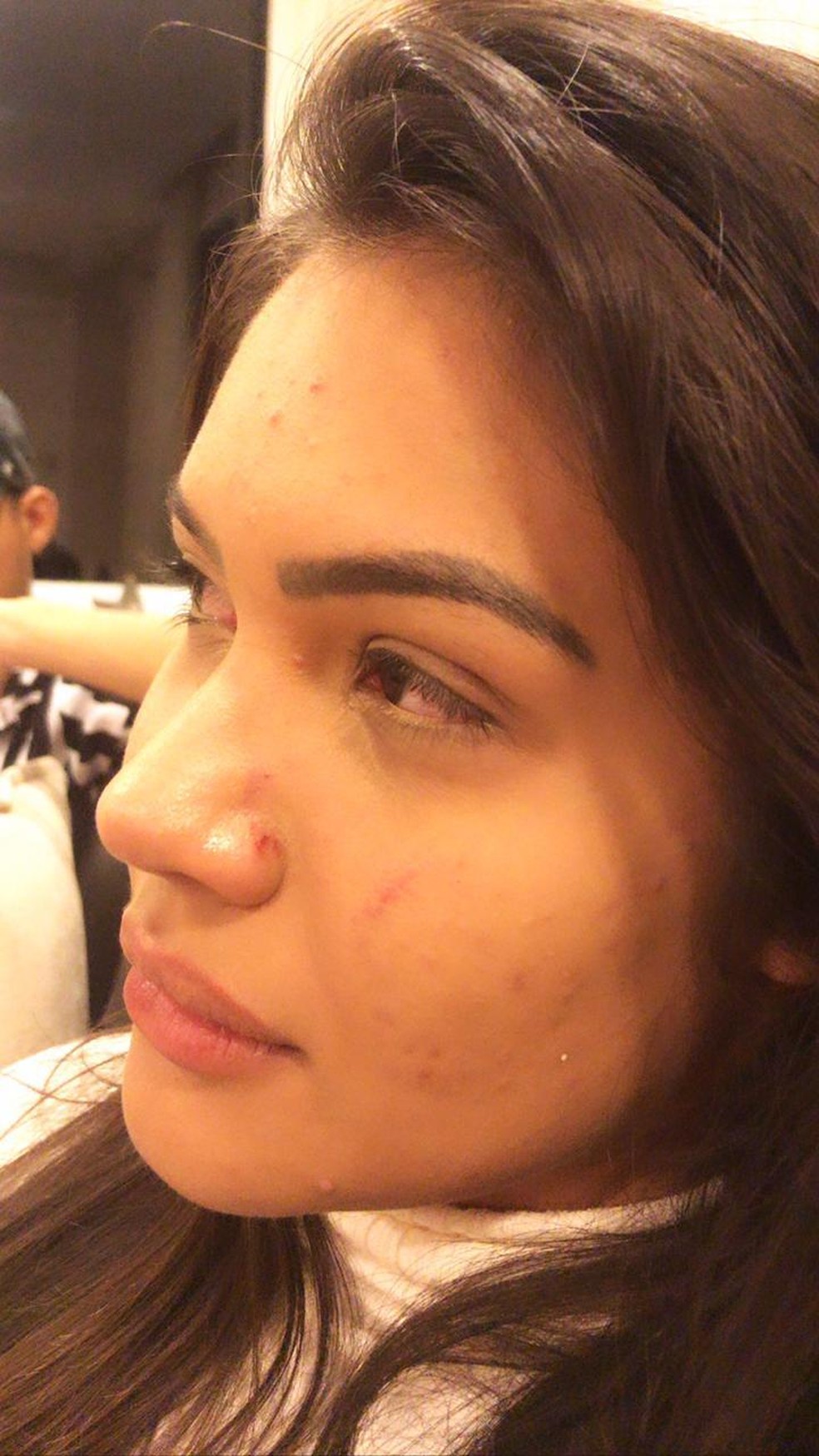 Influenciadora digital Ayarla Souza ficou com o rosto arranhado após as agressões — Foto: Ayarla Souza/Arquivo Pessoal