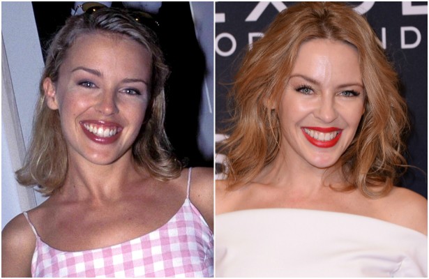 A diva australiana do pop, Kylie Minogue, estava com 26 anos em fevereiro de 1995. Atualmente tem 46, e o mesmo sorrisão de sempre. (Foto: Getty Images)