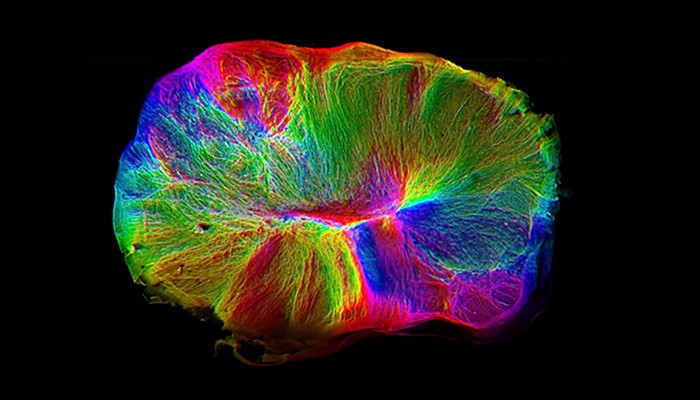 Cientistas desenvolvem "minicérebro" em laboratório - Revista Galileu | Ciência