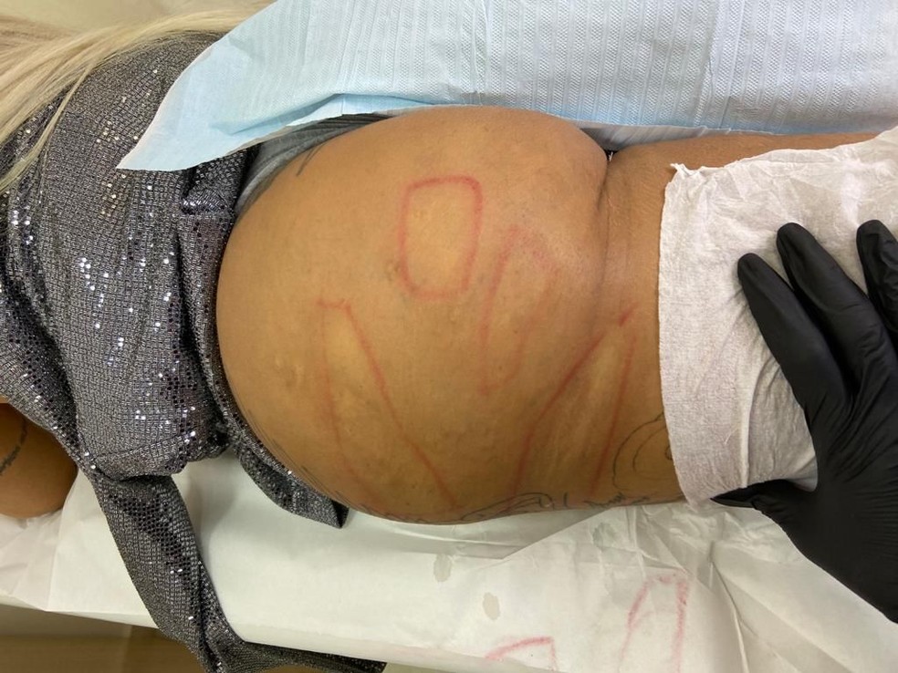 Juju Ferrari mostra marcas no bumbum — Foto: Divulgação / CO Assessoria