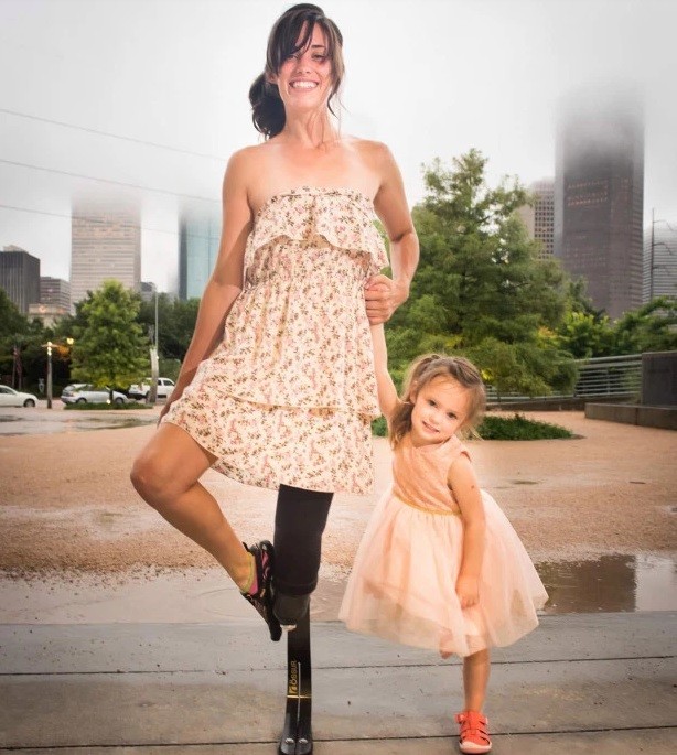Mãe opta por amputar a perna para salvar filha (Foto: Reprodução)