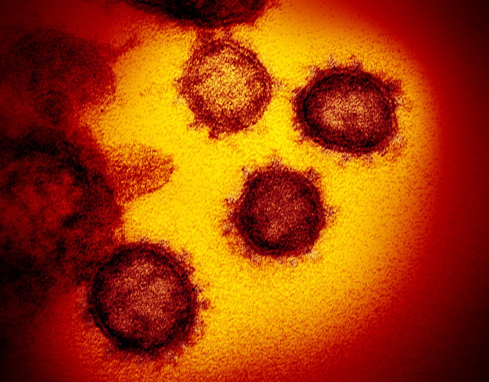 Imagem microscópica do novo coronavírus 2019 n-CoV — Foto: NIAID-RML/AP