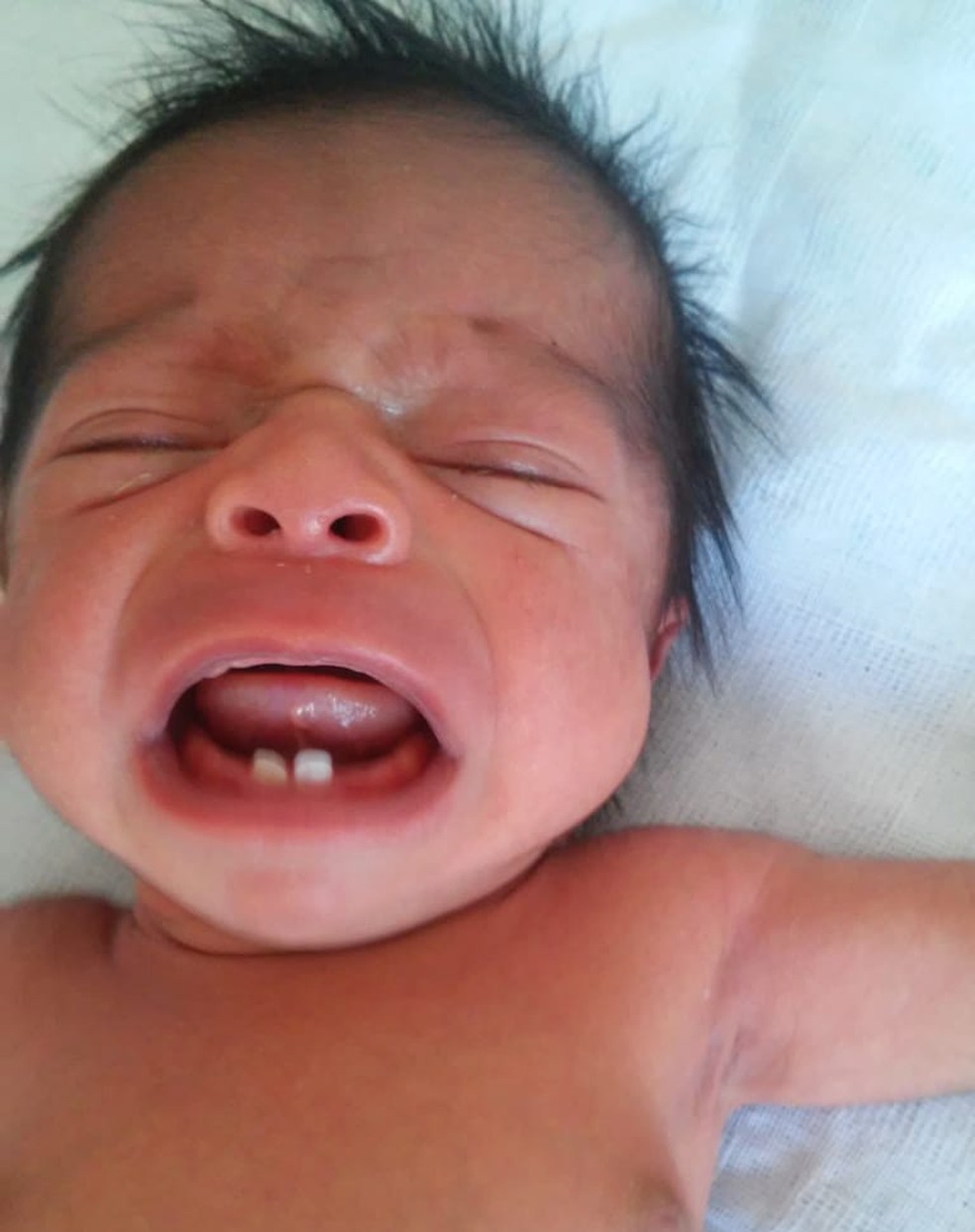 BebÃƒÂª nasceu com dois dentes em Sorocaba Ã¢â‚¬â€ Foto: Ana Carolina Soares/Arquivo pessoal