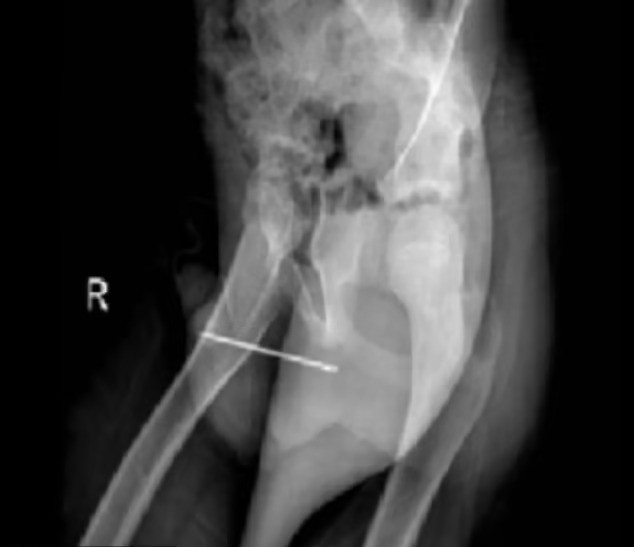 Raio X anexado em relatório médico mostra agulha dentro do garoto (Foto: Reprodução 'Urology Case Reports')