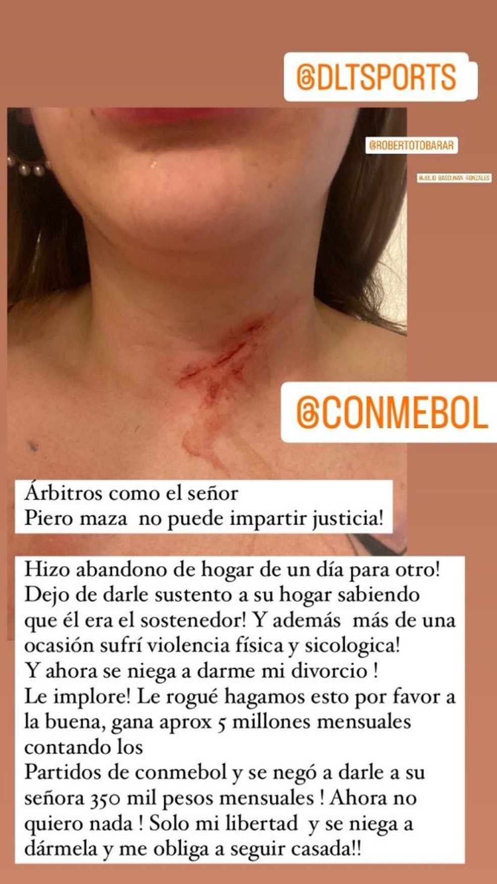 &Aacute;rbitro de Del Valle x Flamengo &eacute; acusado por esposa de viol&ecirc;ncia dom&eacute;stica, que exp&otilde;e ferida no pesco&ccedil;o &mdash; Foto: Reprodu&ccedil;&atilde;o