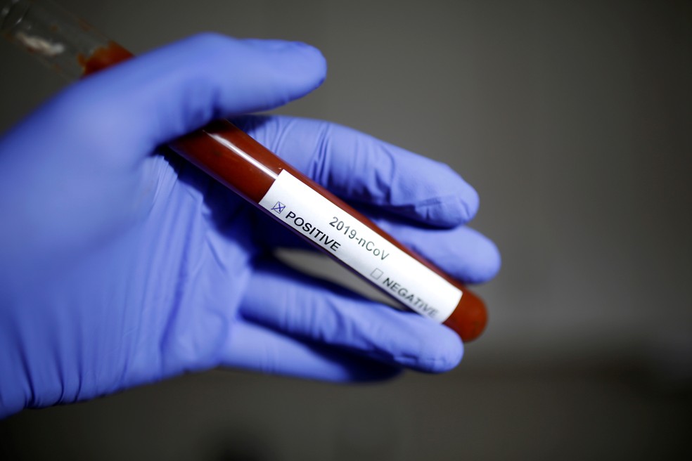 Foto ilustrativa mostra resultado positivo para o novo coronavírus  — Foto: Dado Ruvic/Reuters/Arquivo