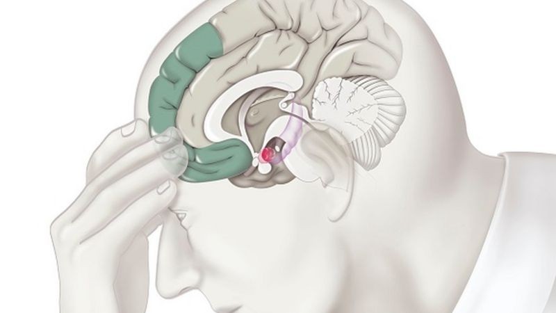 O córtex pré-frontal (destacado em verde escuro na ilustração) só se desenvolve completamente entre os 25 e os 30 anos (Foto: Getty Images via BBC News)