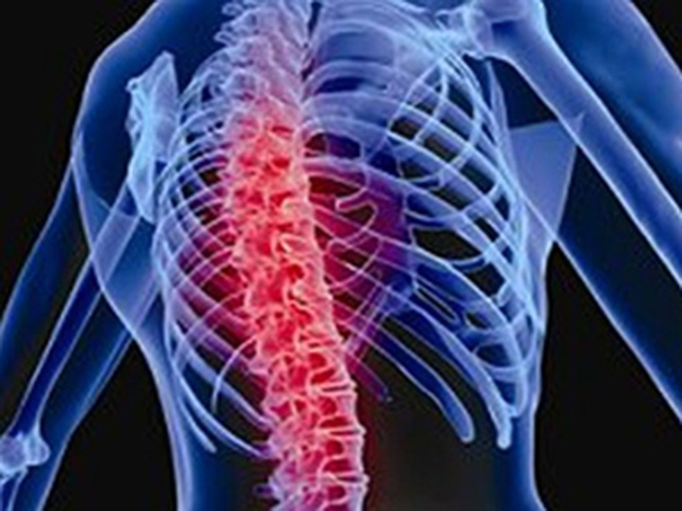 Estresse ajuda a tensionar a coluna vertebral. — Foto: Istockphoto/S.Kaulitzki/Nasa