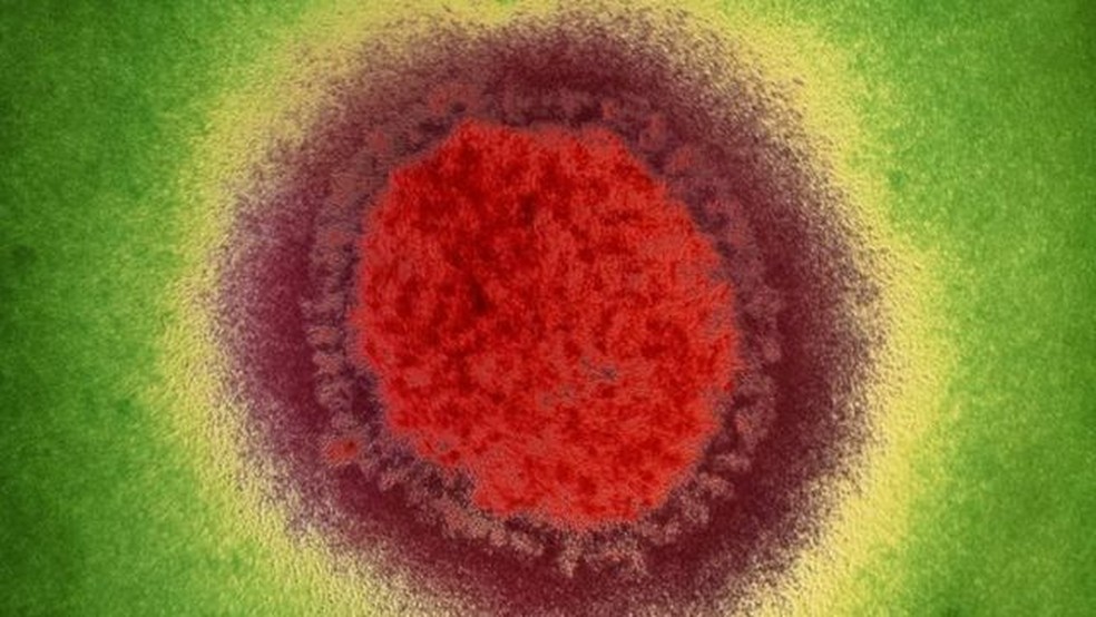 Vírus da influenza, causador da gripe, praticamente desapareceu no início da pandemia, surpreendendo pesquisadores — Foto: SCIENCE PHOTO LIBRARY via BBC