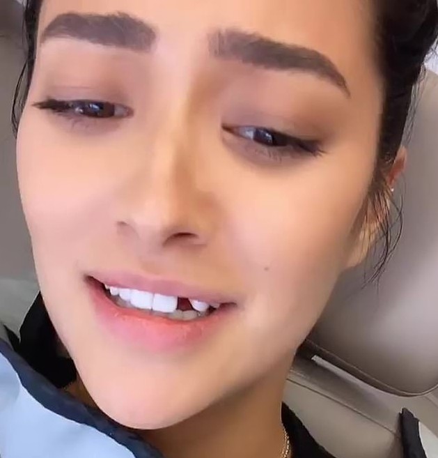 A atriz Shay Mitchell com um dente a menos (Foto: Instagram)