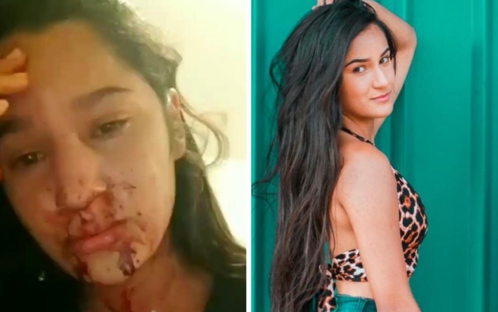 Júlia Almeida denuncia que foi agredida por amigo do namorado, em Aguas Lindas de Goiás  — Foto: Instagram\Reprodução