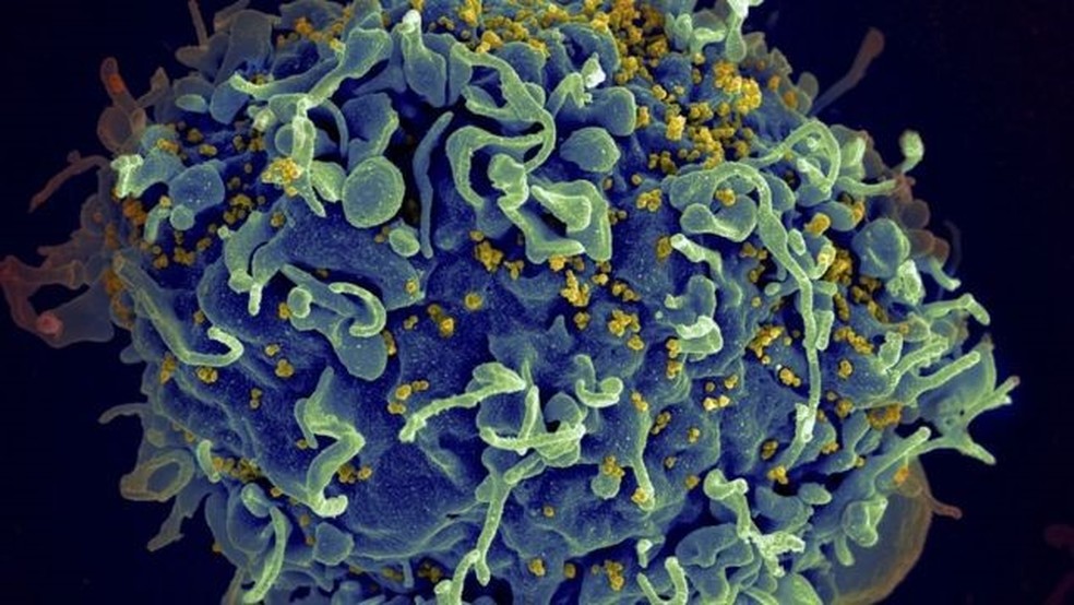 Eletromicrografia mostra HIV infectando célula humana — Foto: Getty Images via BBC