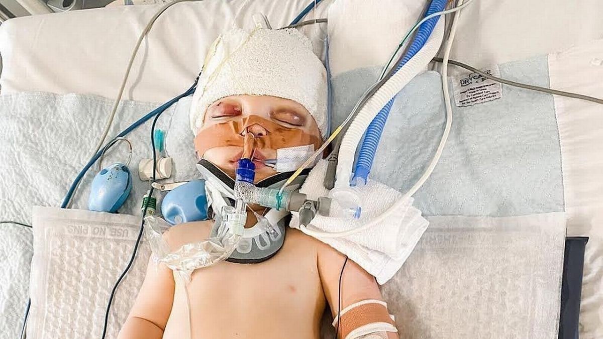 O menino de dez meses precisou passar por quatro cirurgias (Foto: Reprodução/Mirror)