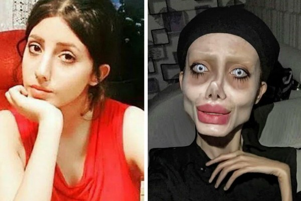 A jovem iraniana Sahar Tabar antes e depois dos procedimentos para ficar igual a Angelina Jolie (Foto: Instagram)