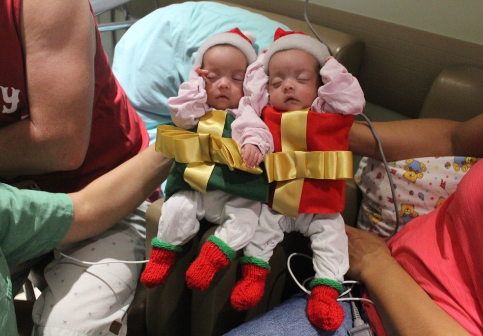 Gêmeas que estão na UTI desde 13 de outubro, devem permanecer no local até segunda-feira (23) — Foto: Hospital Divina Providência/Divulgação